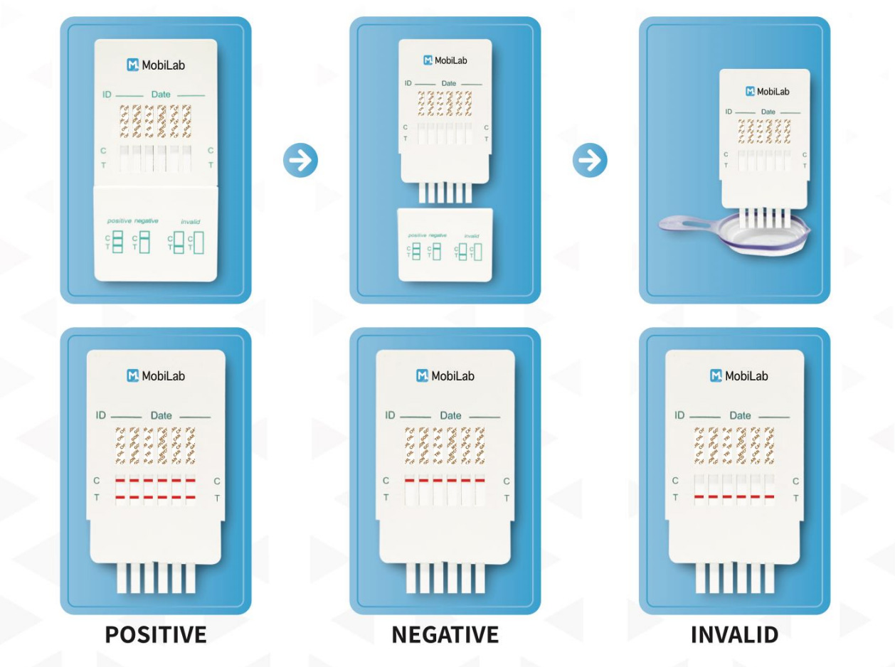 UroSure Test Results Guide - How to Read Positive, Negative, and Invalid Results